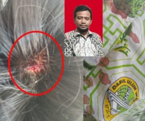 Guru BK MTS.DARUL ULUM Kurek Sari Waru Sidoarjo,Memukul Dengan Benda Tajam Kemurid Didiknya Sampai Berdarah-darah